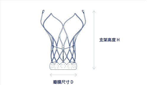 主动脉瓣膜