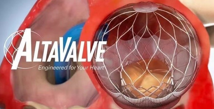 心通医疗联营公司4C Medical获得1.75亿美元D轮优先股融资