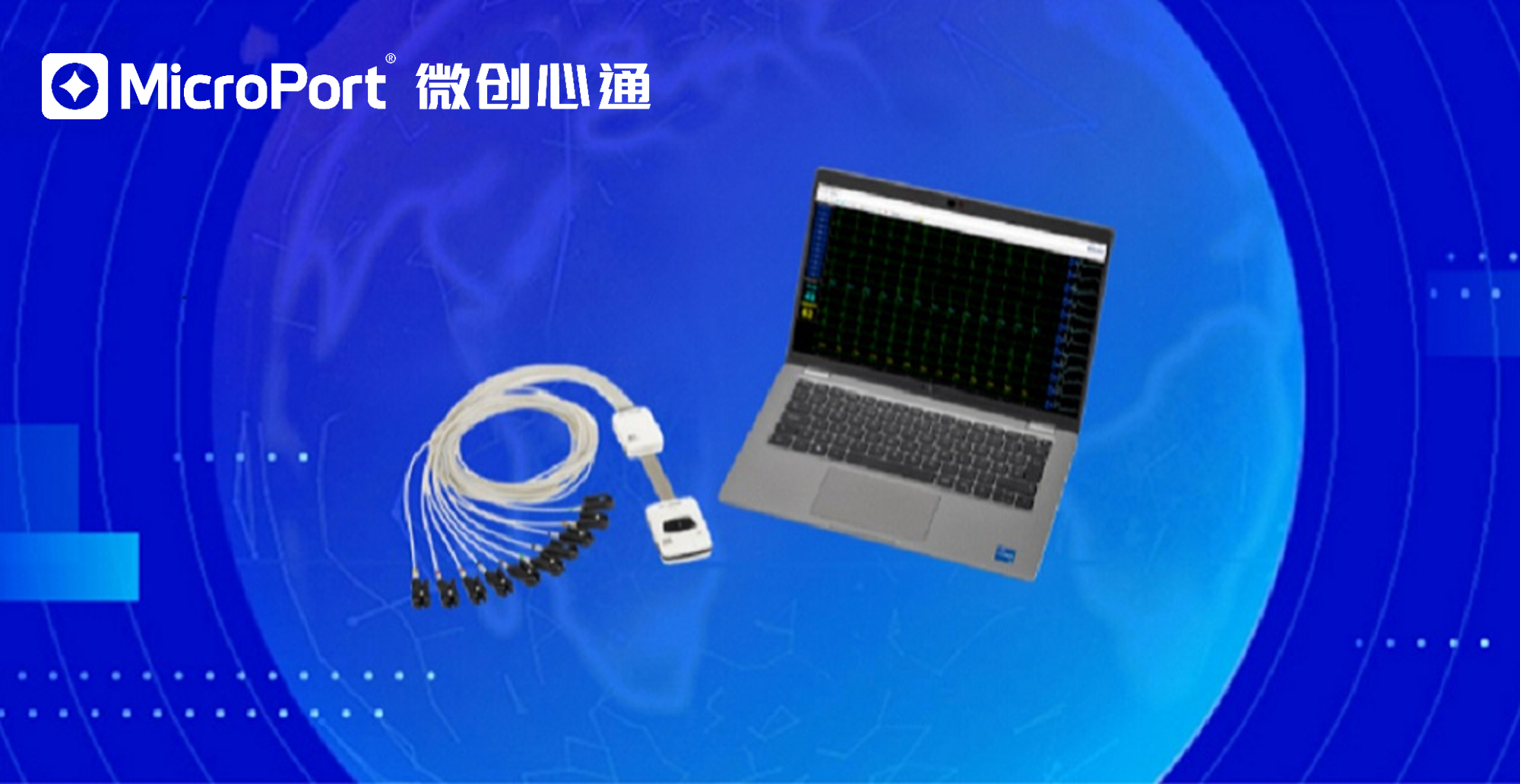 微创<sup>®</sup>心通LBBOT创新解决方案获欧盟及澳大利亚批准上市